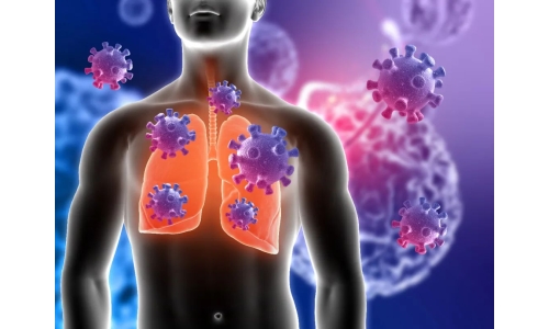 钟南山：6月底将迎来二阳高峰！危害更大？NMN能有效抵御“二阳”！